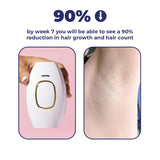 IPL Laser Hair Removal | The Leading At-Home Solution for Smooth Skin