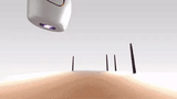 IPL Laser Hair Removal | The Leading At-Home Solution for Smooth Skin