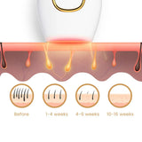 IPL Laser Hair Removal | The Leading At-Home Solution for Smooth Skin