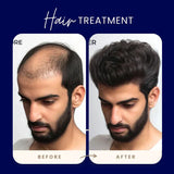 FEG Plus Hair Strong Growth Spray 100% Original For Men & Women